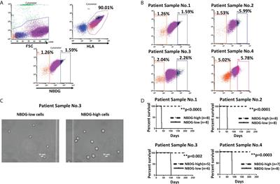 A distinct subpopulation of leukemia initiating cells in acute precursor B lymphoblastic leukemia: quiescent phenotype and unique transcriptomic profile